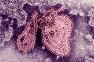 Mumps virus Pictures