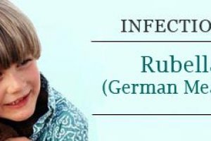 Rubella signs and symptoms in adults